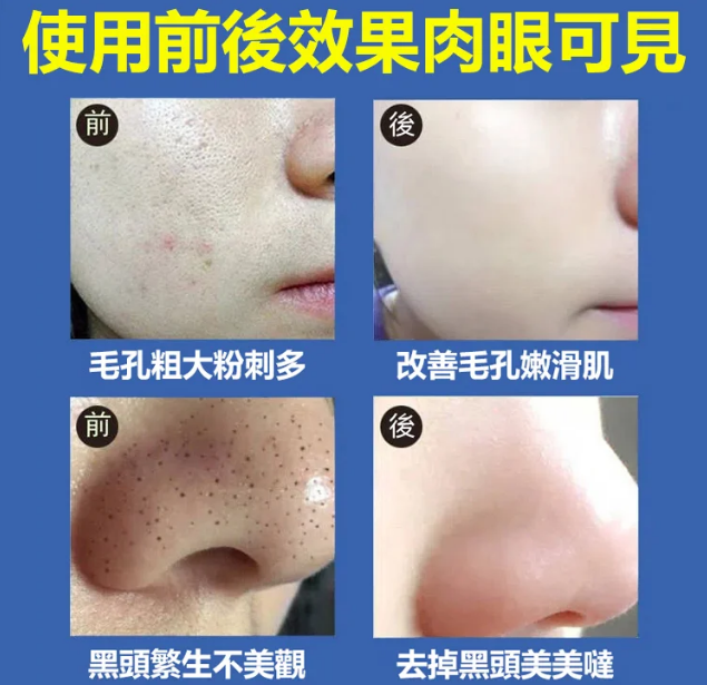 【官方正品 買二送一】醫用級美白潔面乳!告別黃黑皮！一洗就白！越洗越白！深層淡黑！